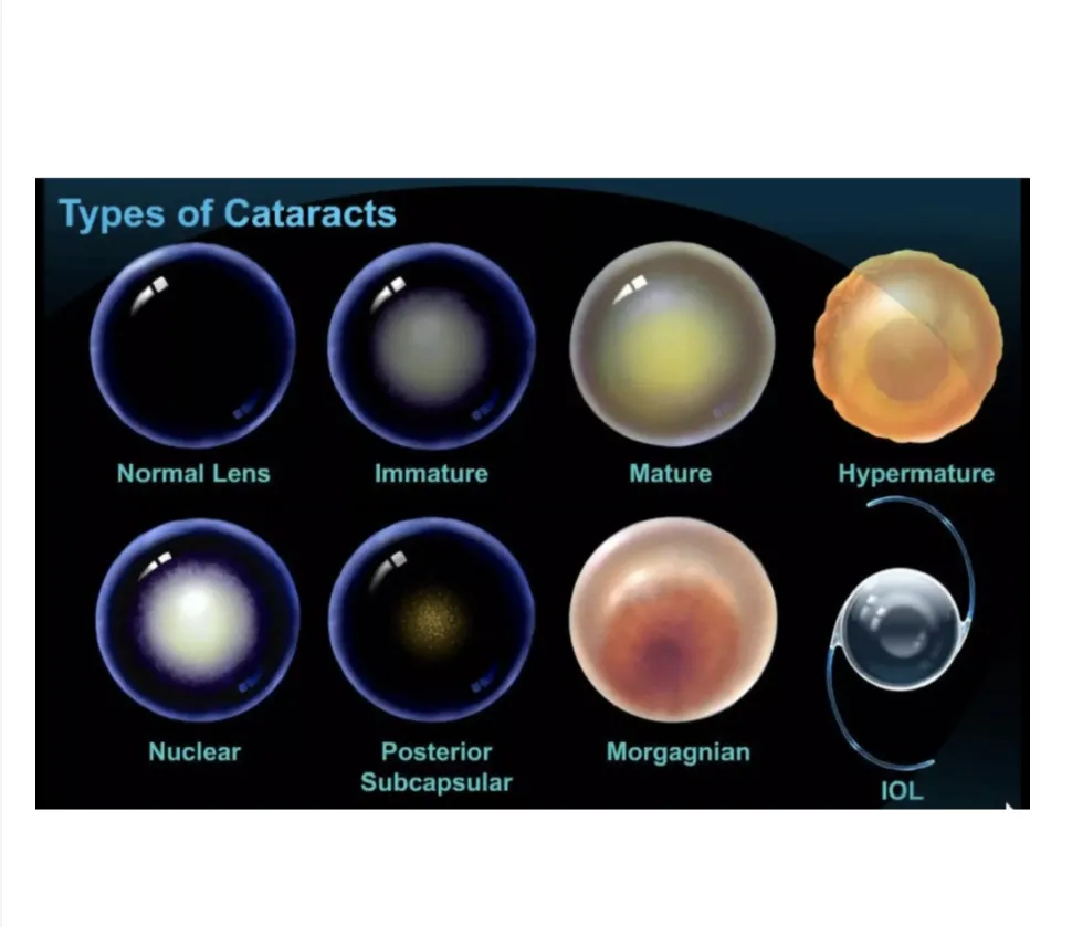 [Vets Recommend!] Lanomax 10ml: Cataract Dissolving Lanosteral Eye Drops for Pets and Animals